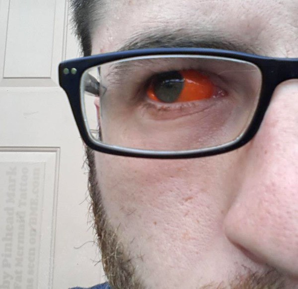 eyeballs-22-orange